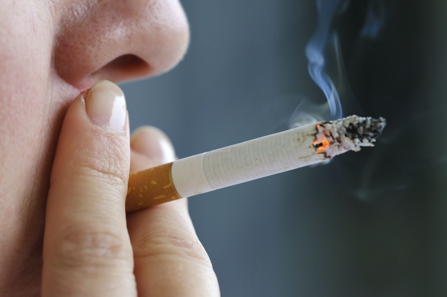 The Impact of Smoking on Periodontal Health