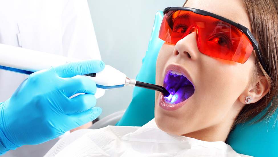 What You Need To Know About Laser Dentistry