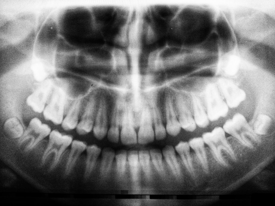 Dental Emergency Kits: What to Include for On-the-Go Preparedness
