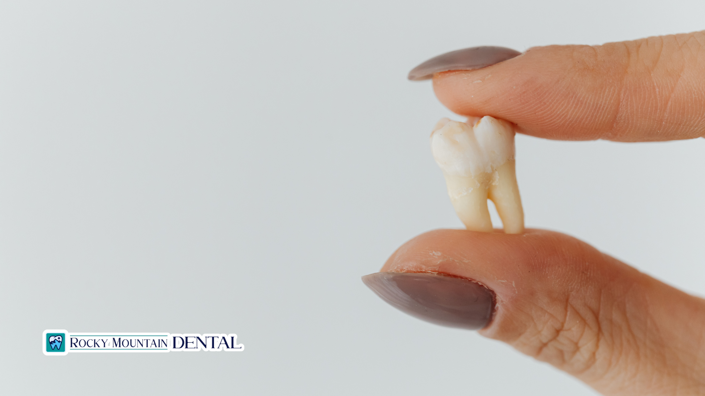 How to Recognize and Treat an Impacted Tooth