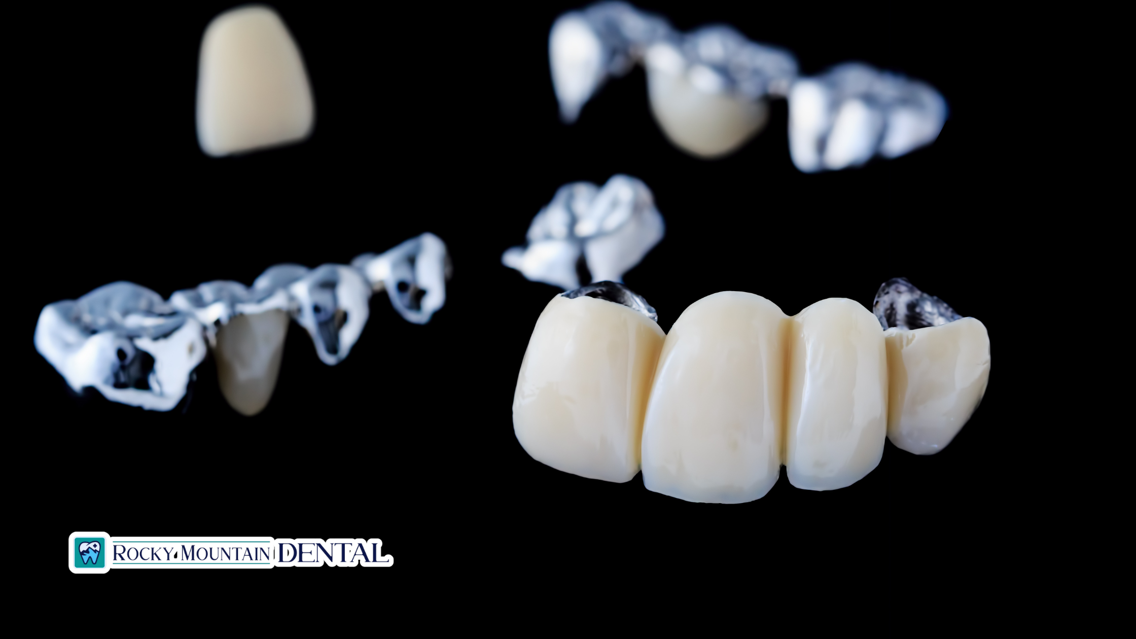 How a Dental Bridge Can Restore Your Smile