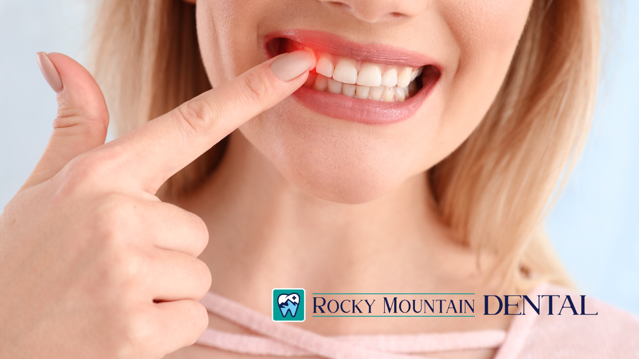 What is a Dental Abscess and Is It Dangerous