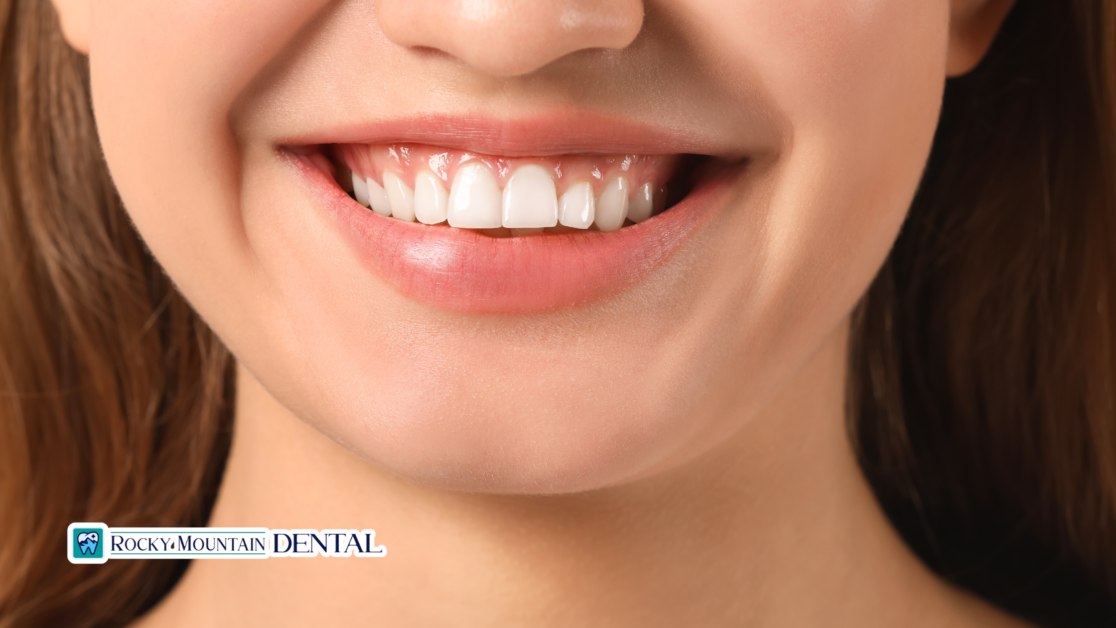 Can Cosmetic Dentistry Correct a Gummy Smile