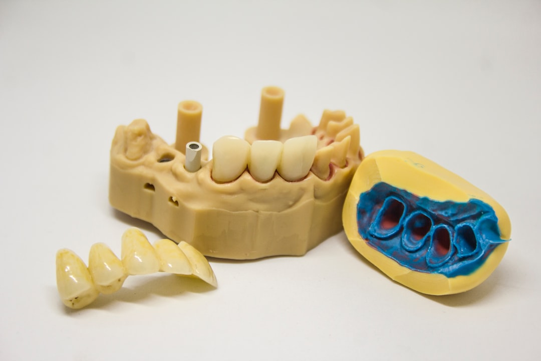 Photo Dentistry - Extractions