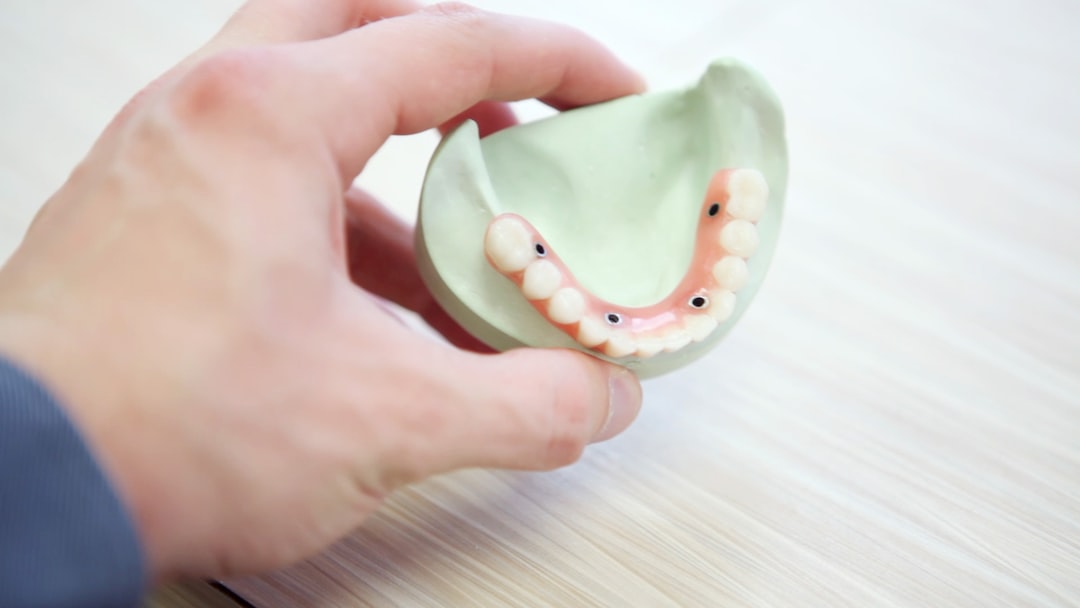 Your Brampton Dentist Breaks Down The Differences Between Dental Crown And Bridges