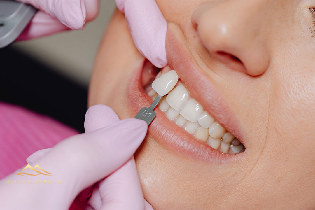 Common Causes of Dental Emergencies