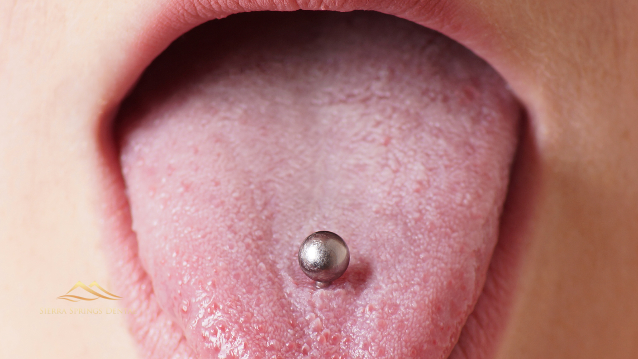 How Oral Piercings Affect Long-Term Dental Health