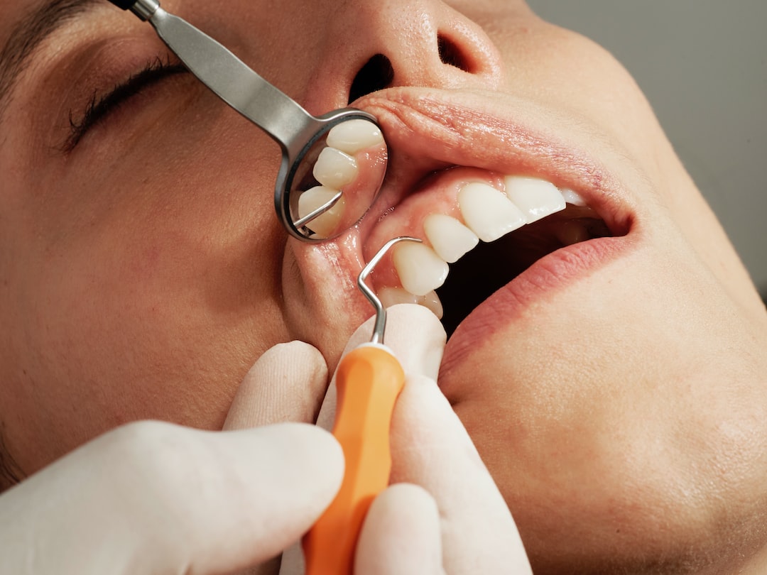 5 Reasons Why Regular Visits to the Dentist Are Essential for Your Oral Health