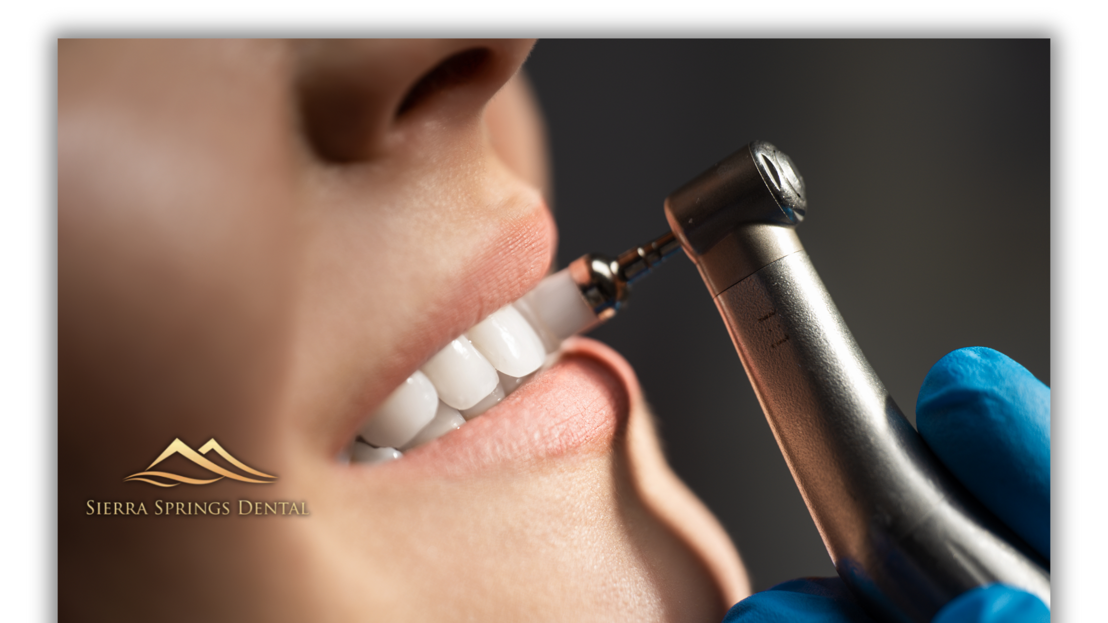 The Long-Term Benefits of Regular Dental Cleanings