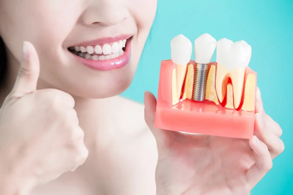 Dental Implant Placement vs. Implant Restoration: What’s the Difference?