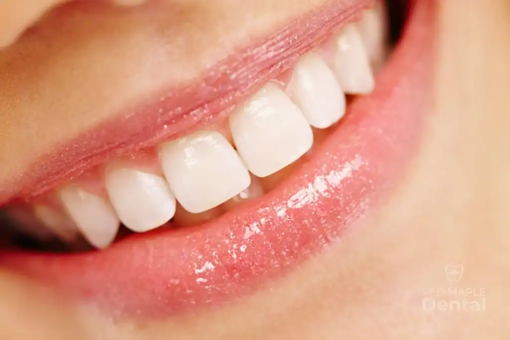How Preventive Care Keeps Your Smile Strong in Brampton