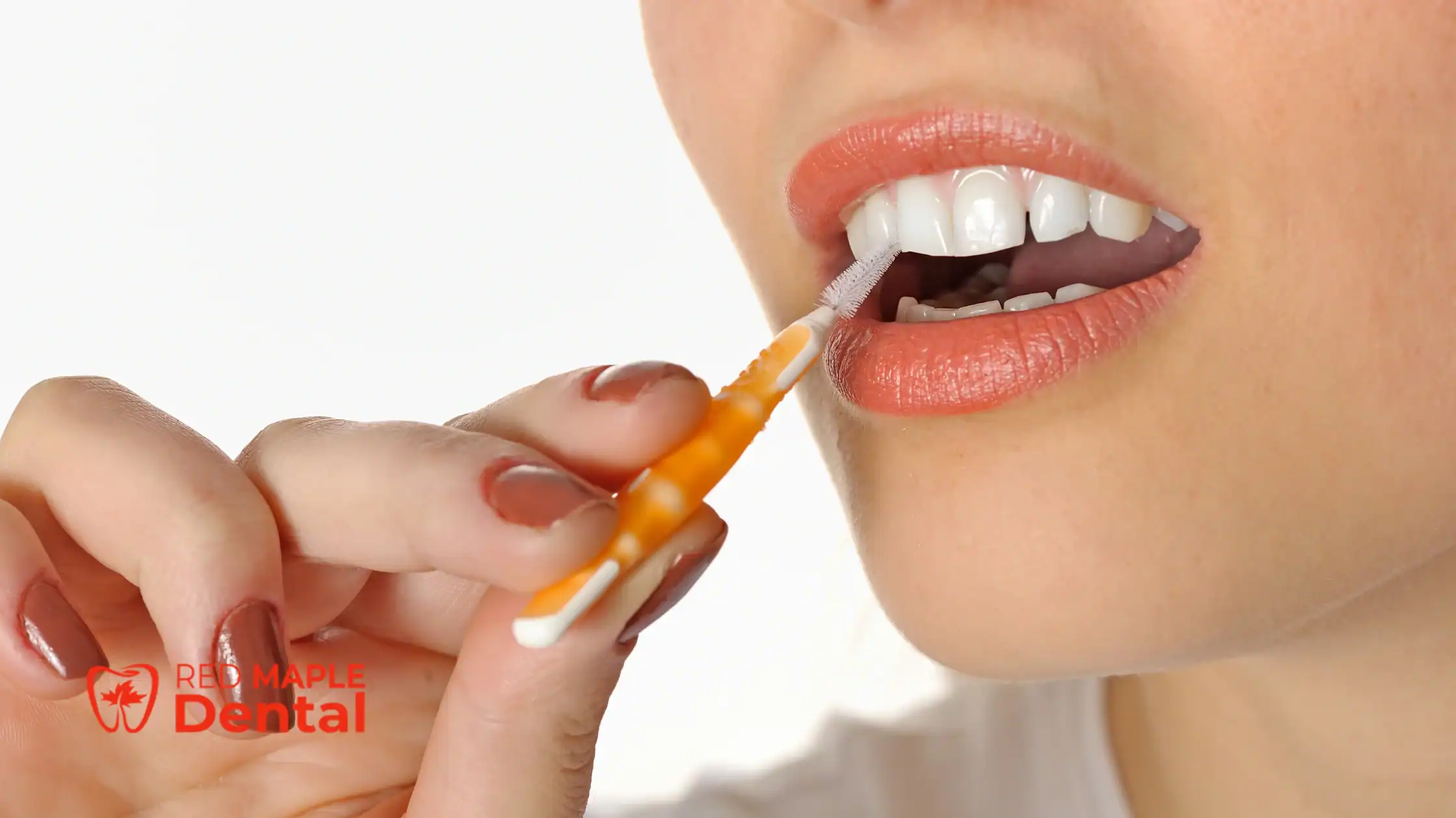 The Role of Interdental Brushes in Oral Care