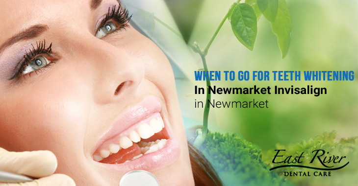 Questions to Ask Before Visiting a Teeth Whitening Clinic!