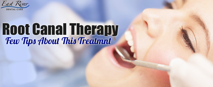 What To Expect During A Root Canal Procedure - Root Canal Newmarket - East River Dental Care - Newmarket Dentist