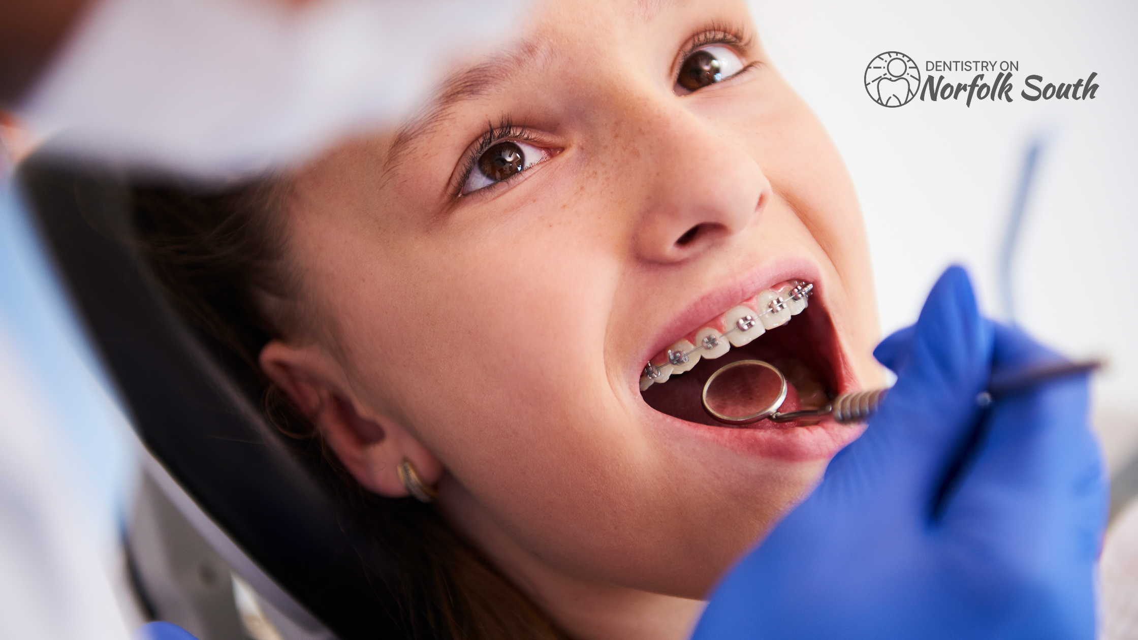 Best Dental Care Tips for Kids with Braces