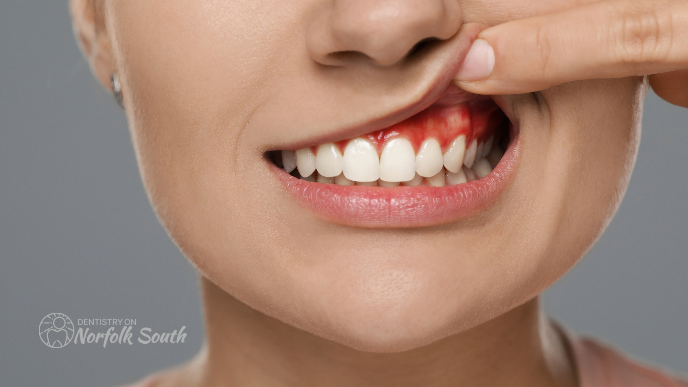 Non-Surgical Treatment Options for Gum Disease