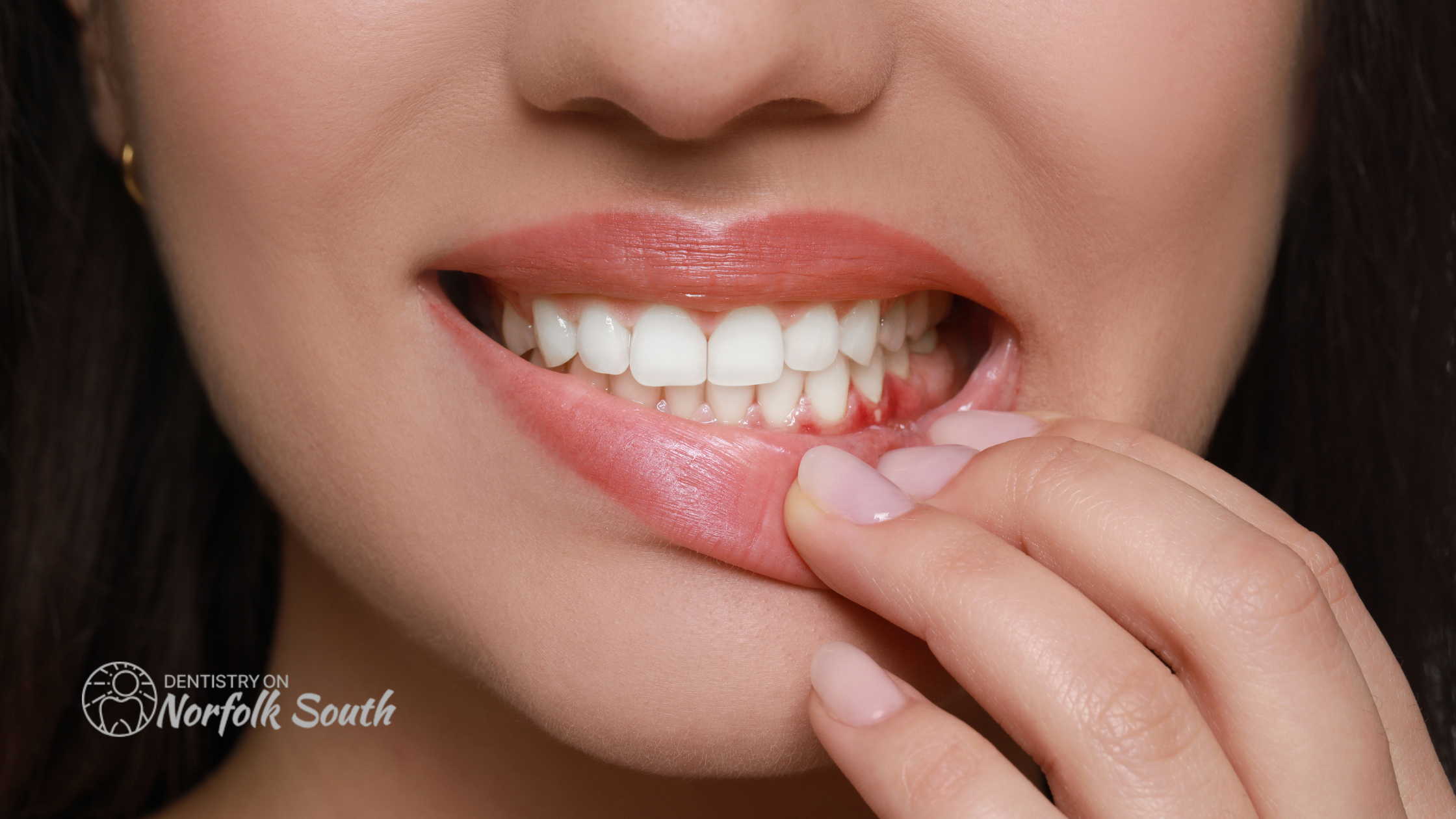 How to Maintain Healthy Gums After Treatment