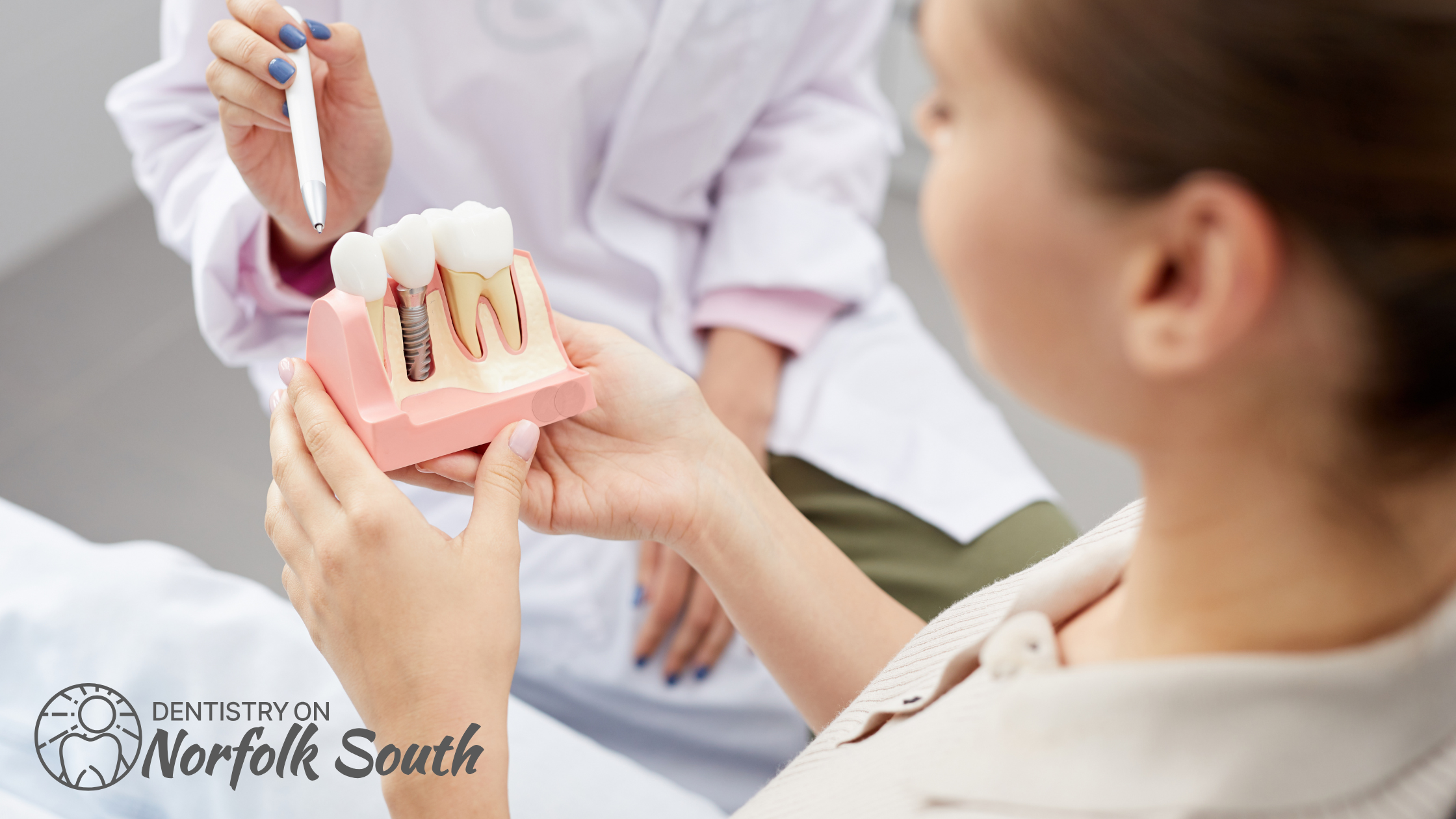 Understanding the Process of Bone Grafting in Implant Dentistry