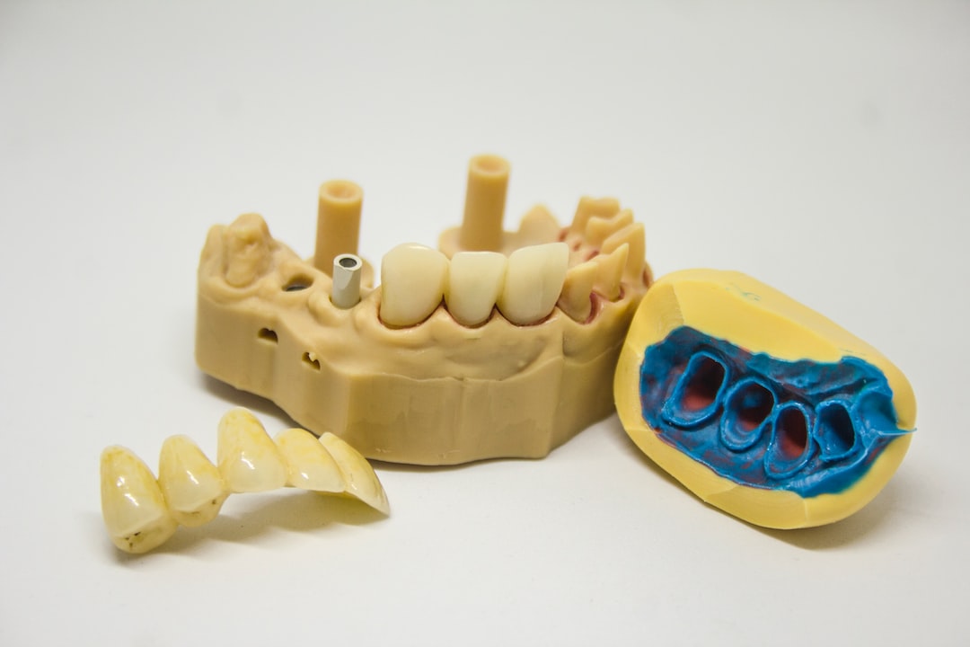 Overcoming Tooth Loss in Edmonton, AB: The Pros and Cons of Dentures