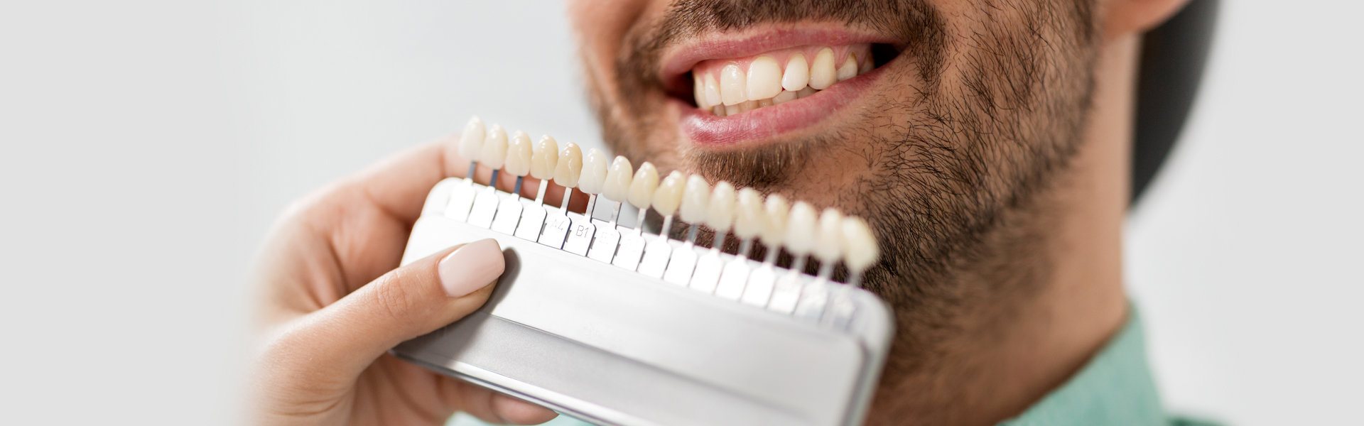 Dentist checking proper dental veneer shade.