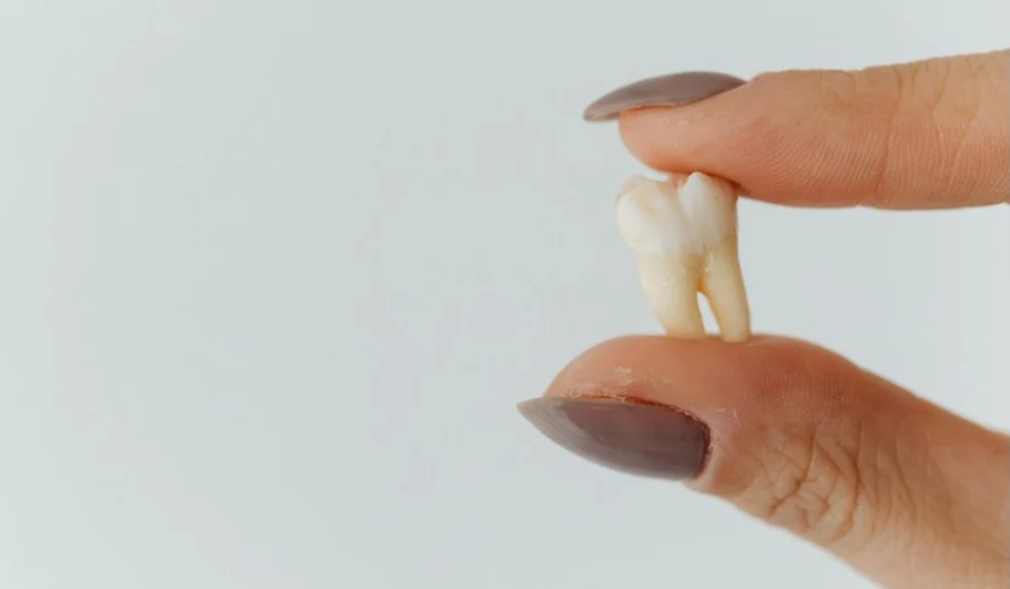 Wisdom Tooth Extraction: Answers to the 10 Most Common Questions at West 17 Avenue Dental