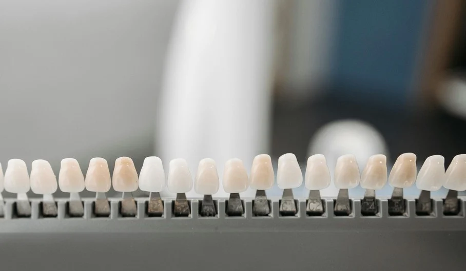 5 Signs Your Smile Could Benefit from Porcelain Veneers at West 17 Avenue Dental