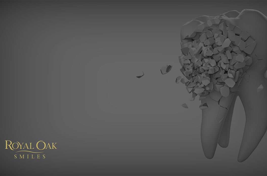 Common Myths About General Dentistry