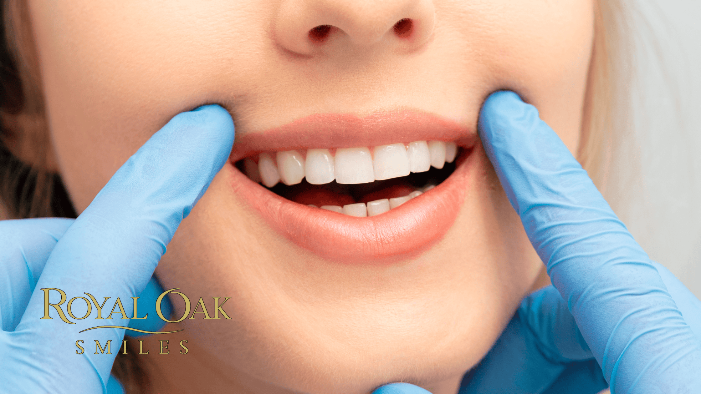 The Science Behind Professional Teeth Whitening Treatments