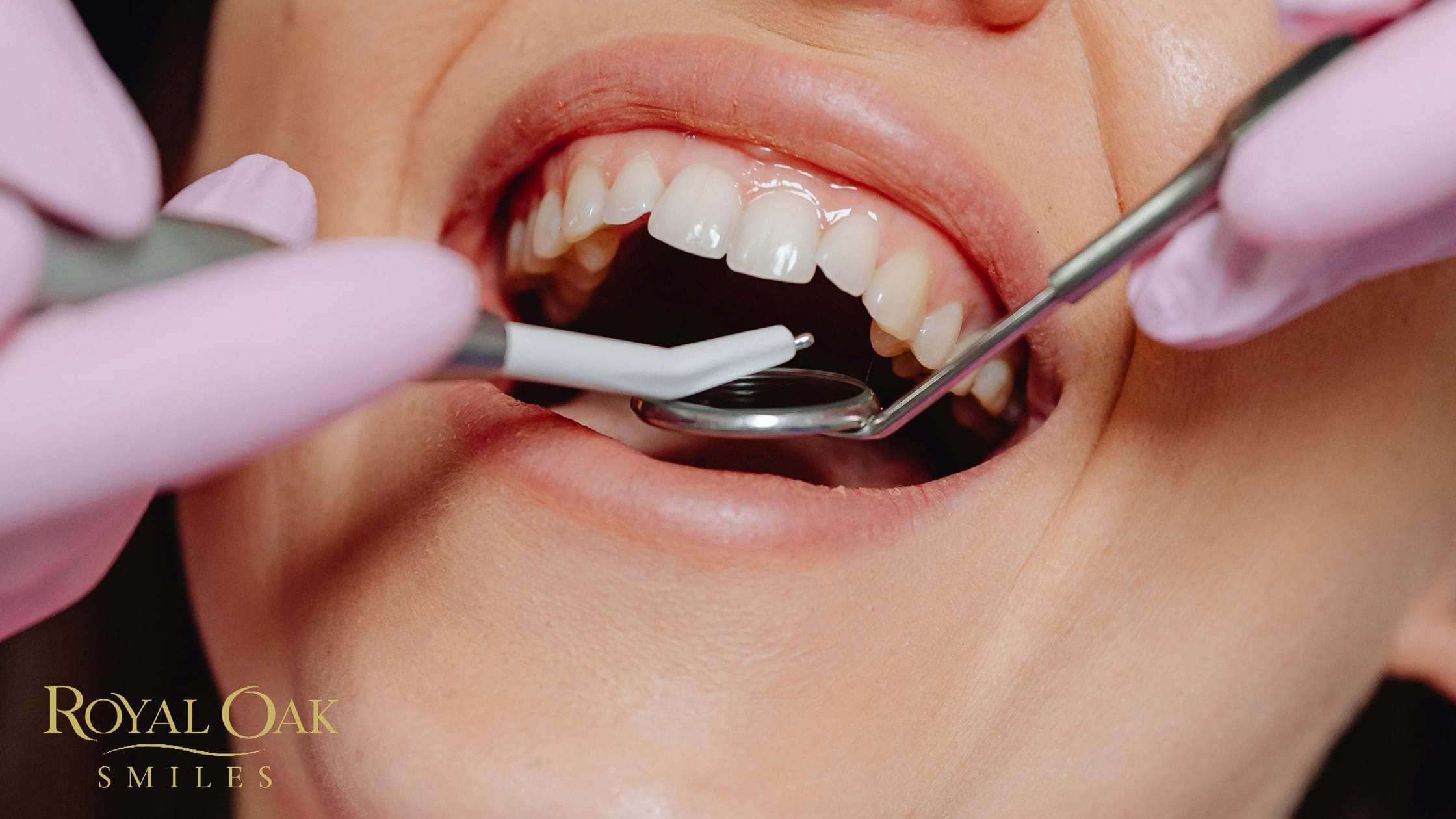 Same-Day Emergency Dentist in Calgary: When You Should Seek Immediate Dental Care