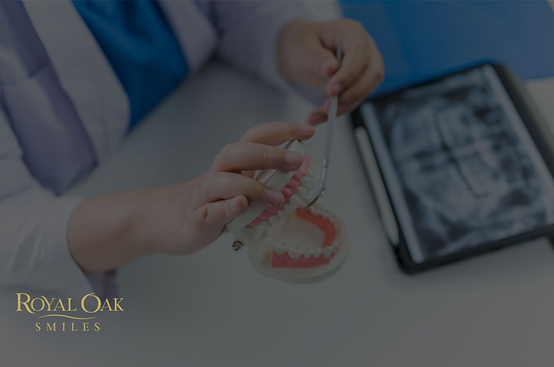 The Impact of Oral Health on General Wellbeing