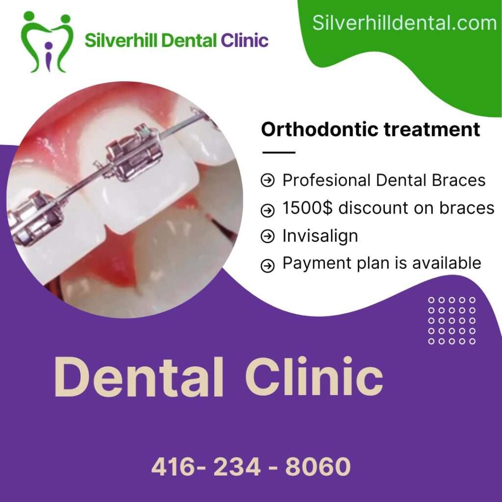 mild underbite at Silverhill Dental in Etobicoke