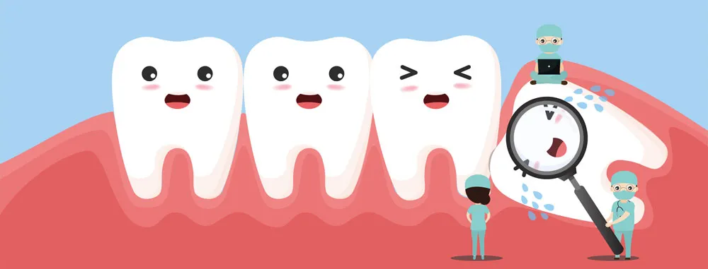 Wisdom Tooth Extraction