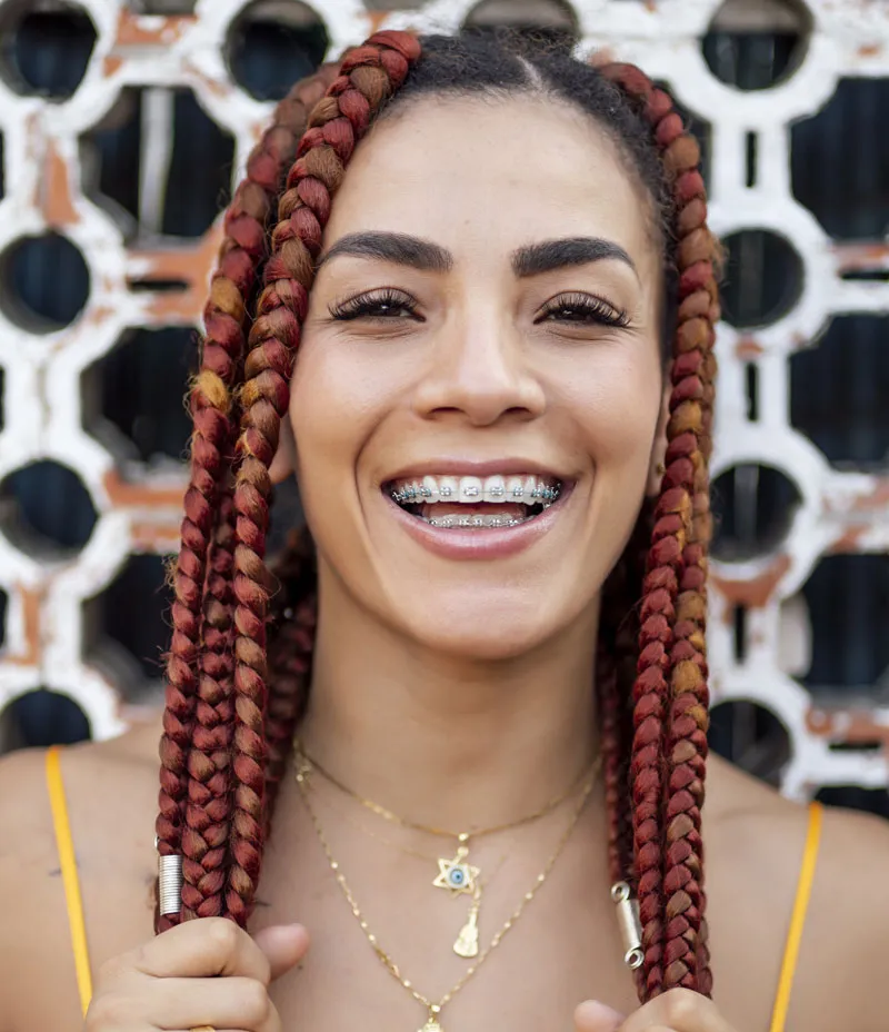 What To Know Before Getting Braces