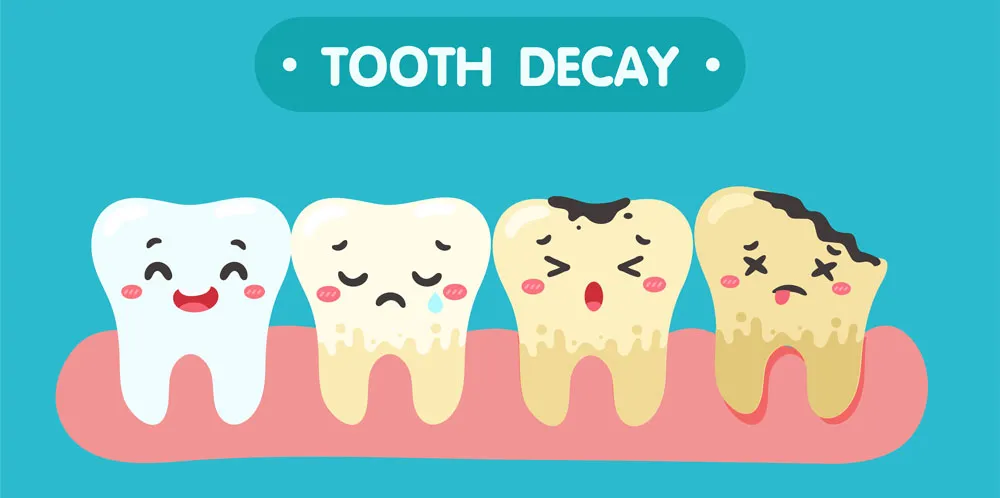 tooth decay symptoms