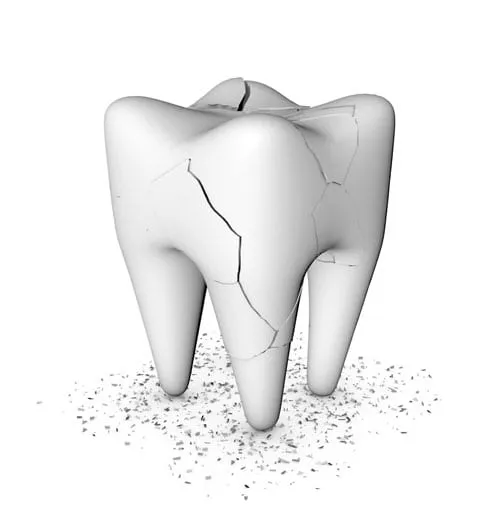 Repair Your Cracked Tooth