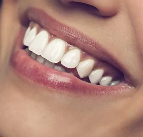 black gums treatment