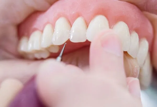 Types of Dentures