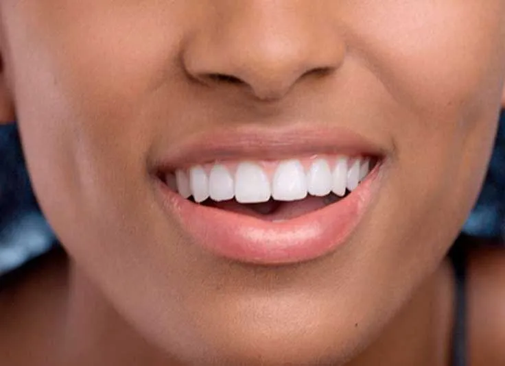 black gums treatment