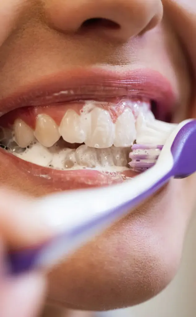 Dental Checkups
