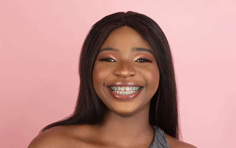 Dental Braces