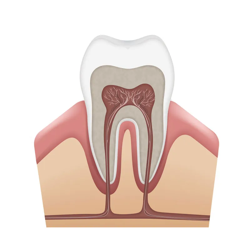 Cement in dentistry