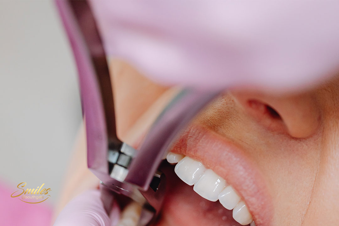 Common Procedures in General and Family Dentistry