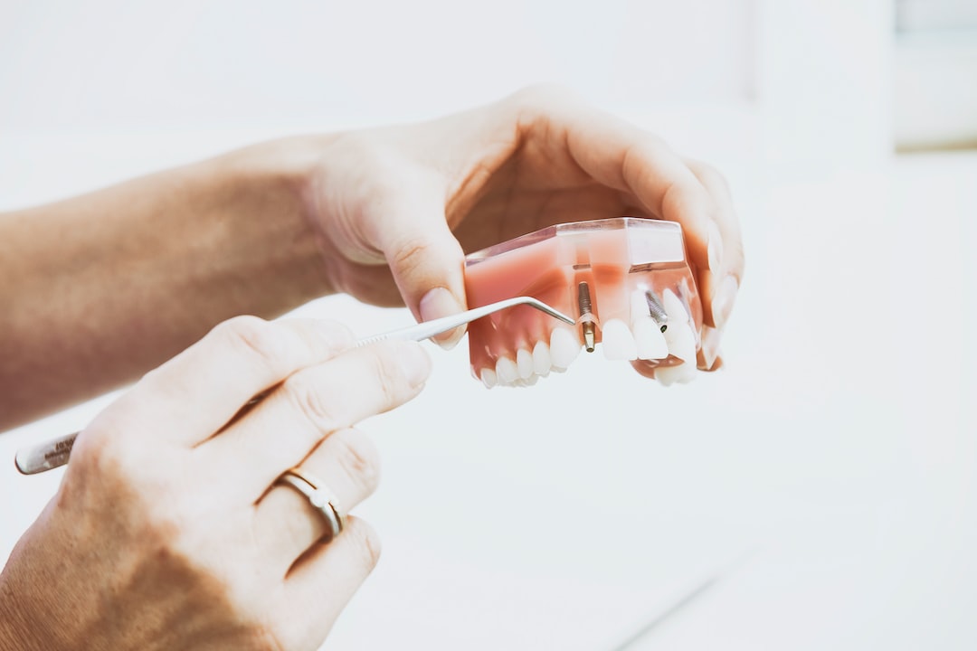 The Importance of Bone Grafting in Dental Procedures