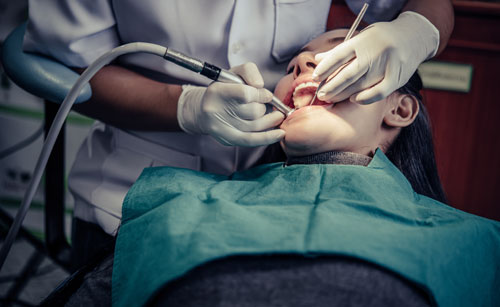 Dental Filling