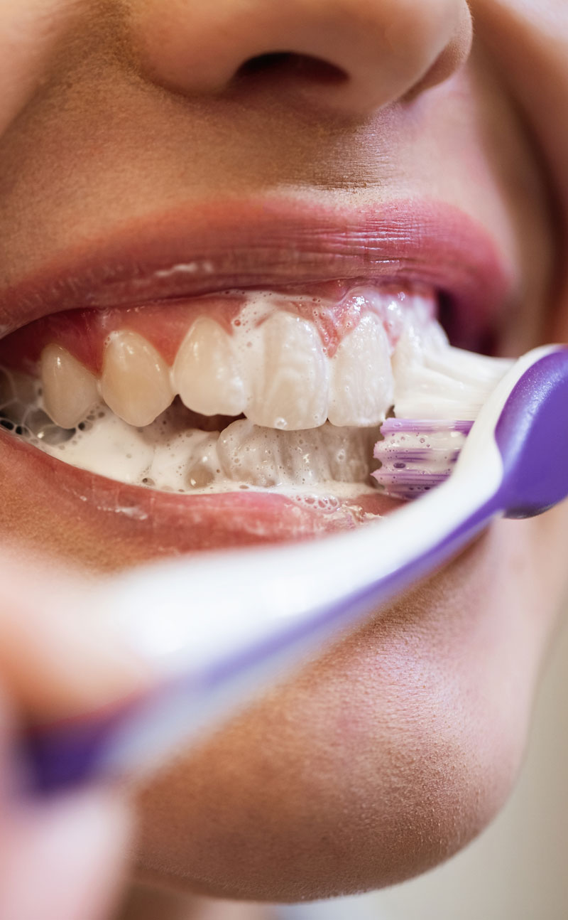 Tooth Cleaning and Aftercare