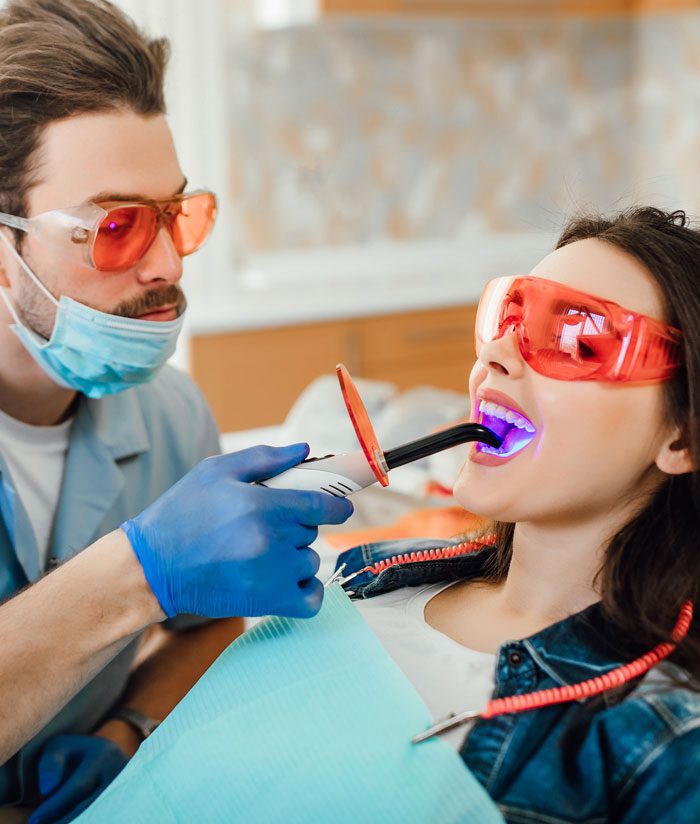 Composite Fillings