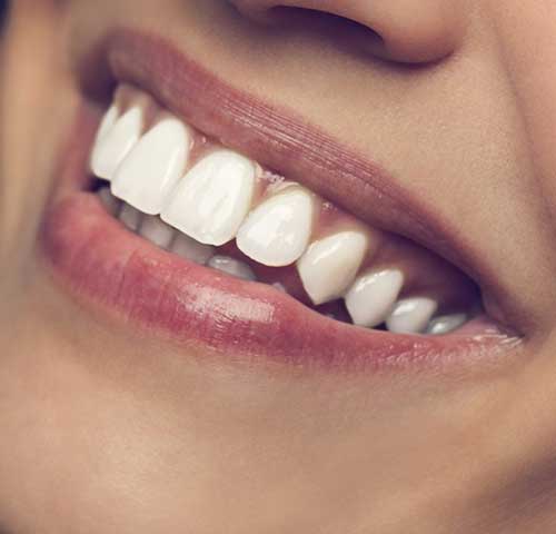 Black Gums