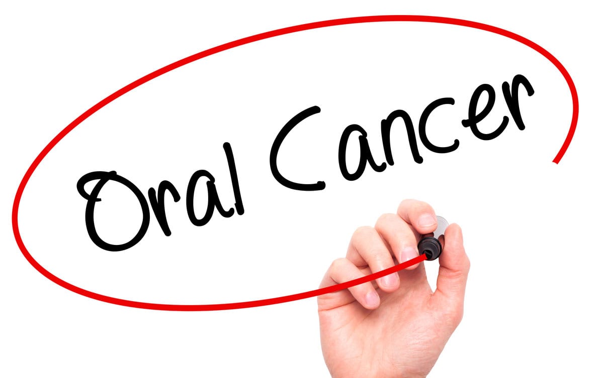 Oral Cancer Treatment