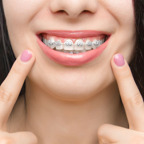 Braces & Orthodontics