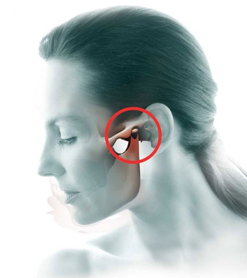 Temporomandibular joint